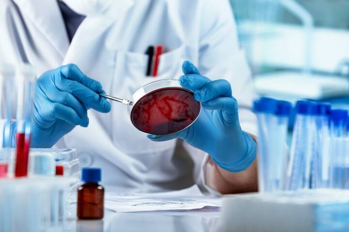 Scientist working with petri plate for analysis in the microscope of the lab. Doctor working and examining cultures in petri dishes in the microbiology lab