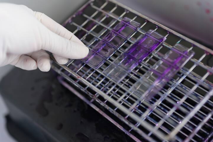 Smear slide staining AFB Stain method.